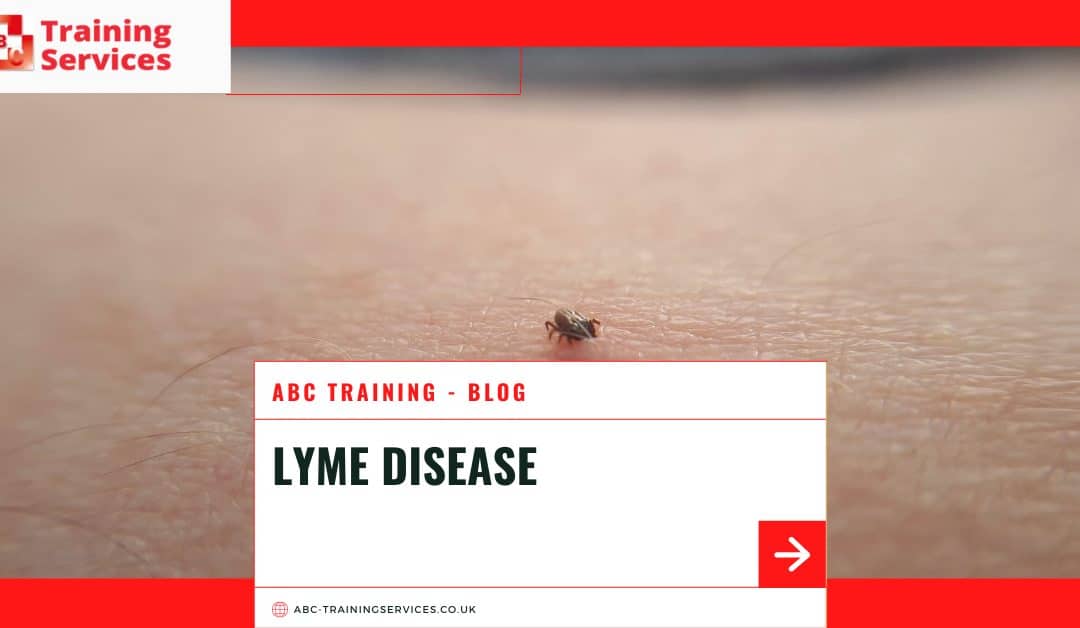 LYME DISEASE: SYMPTOMS, CAUSE AND TREATMENT