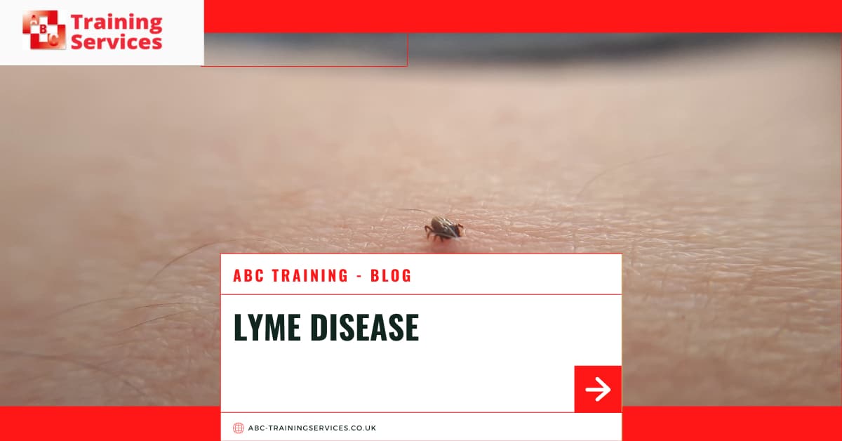 lyme disease